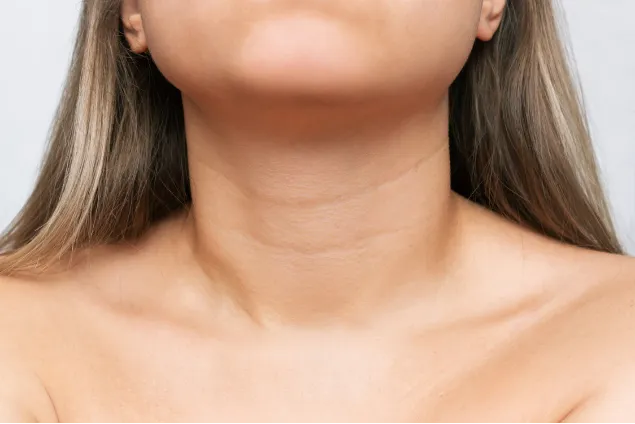 Neck Lines Treatment